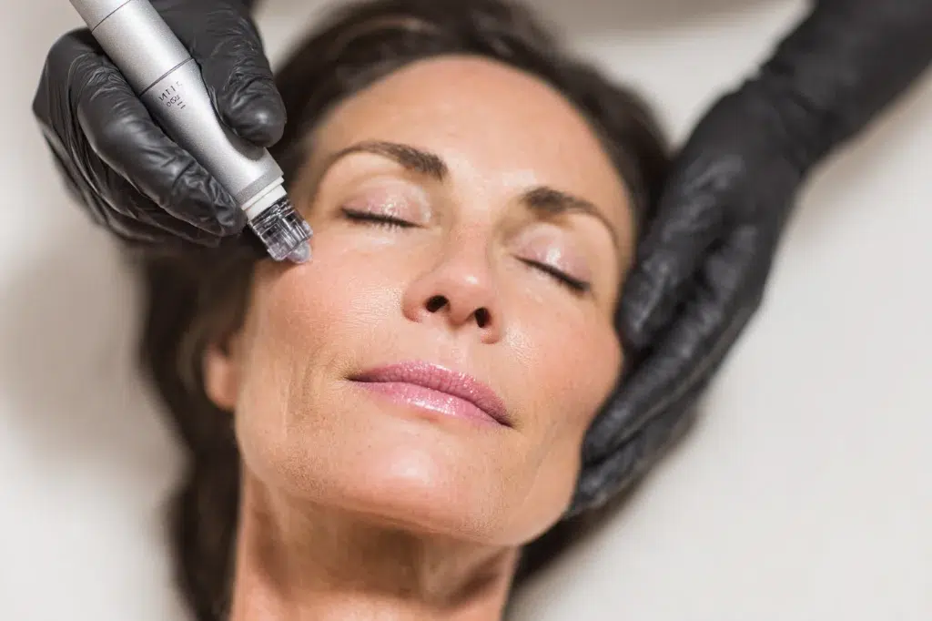 How MiXto Targets Wrinkles and Laxity