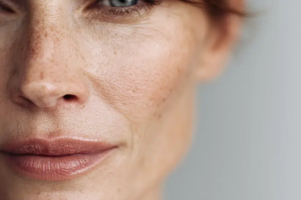 Why Fine Lines Form